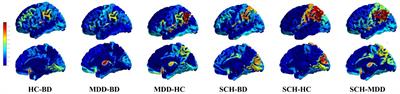 Degeneracy and disordered brain networks in psychiatric patients using multivariate structural covariance analyzes